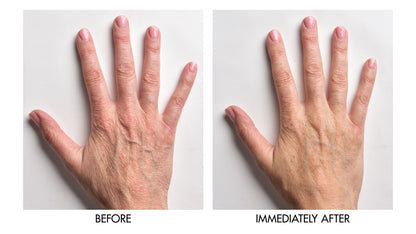 Genie | Instant Hand Perfecter