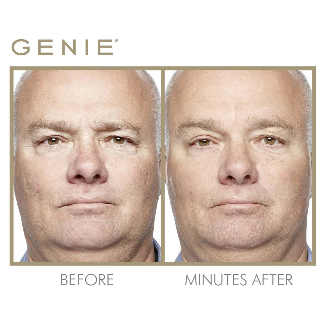 Genie | Instant Line Smoother - 19ml