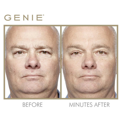 Genie | Instant Line Smoother - 19ml